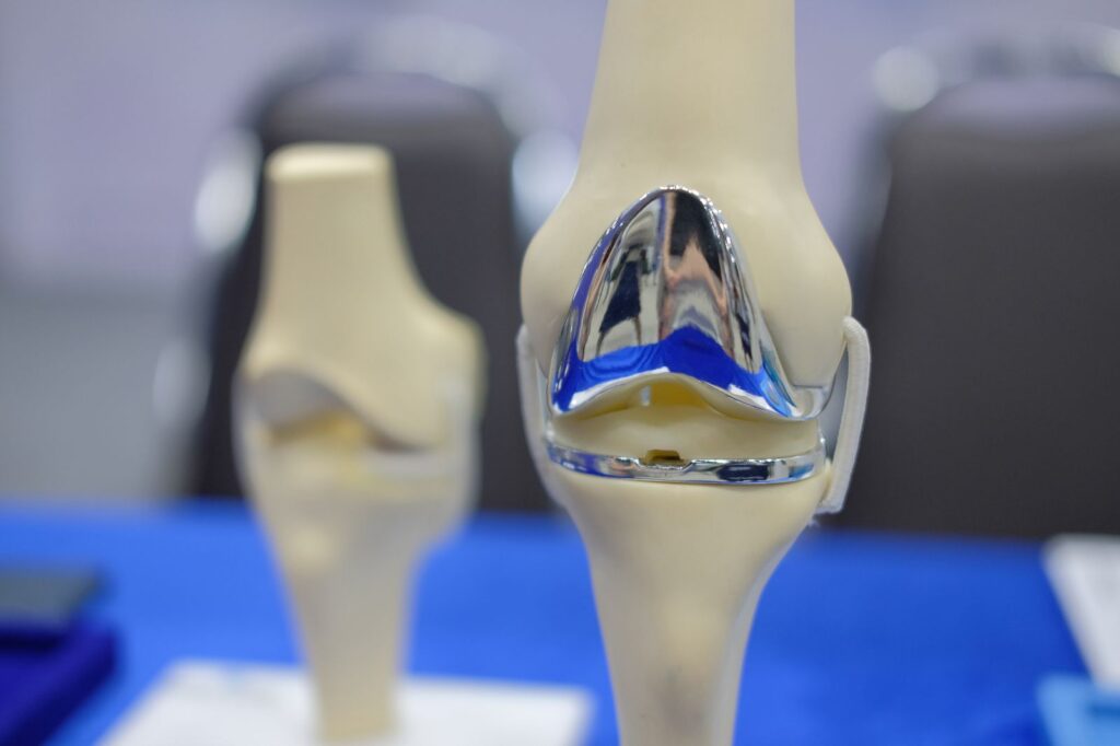مفصل الركبة الصناعي total knee replacement